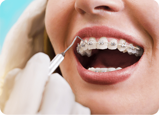 Orthodontic Care