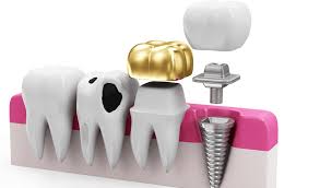 Restorative Dentistry